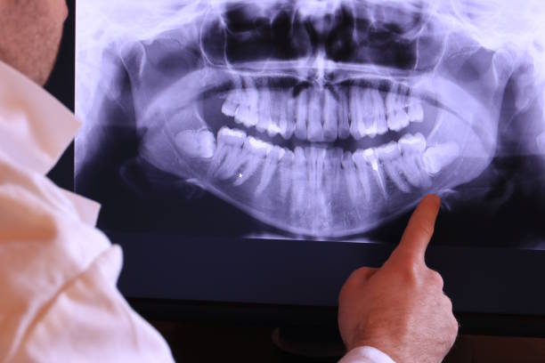 Best Emergency Treatment for Dental Infections or Abscesses in Peru, IL