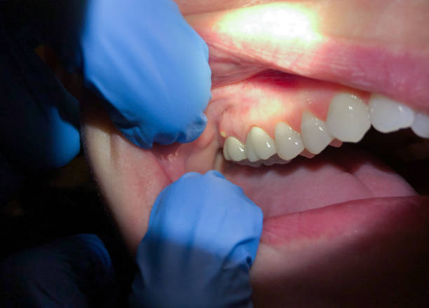 Best Emergency TMJ Treatment in Peru, IL
